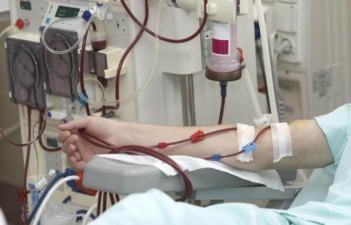 شاخص دستگاه دیالیز به بیمار به 4.5 رسید، ورود 1080 دستگاه همودیالیز شاخص دستگاه دیالیز به بیمار به 4.5 رسید، ورود 1080 دستگاه همودیالیز ایرانی به چرخه درمان