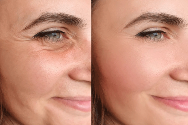 5 راه چاره طلایی و موثر برای سفت شدن پوست صورت